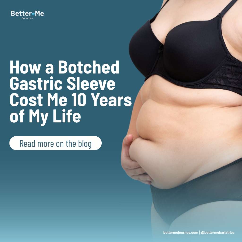 botched-gastric-sleeve-cost-me-10-years